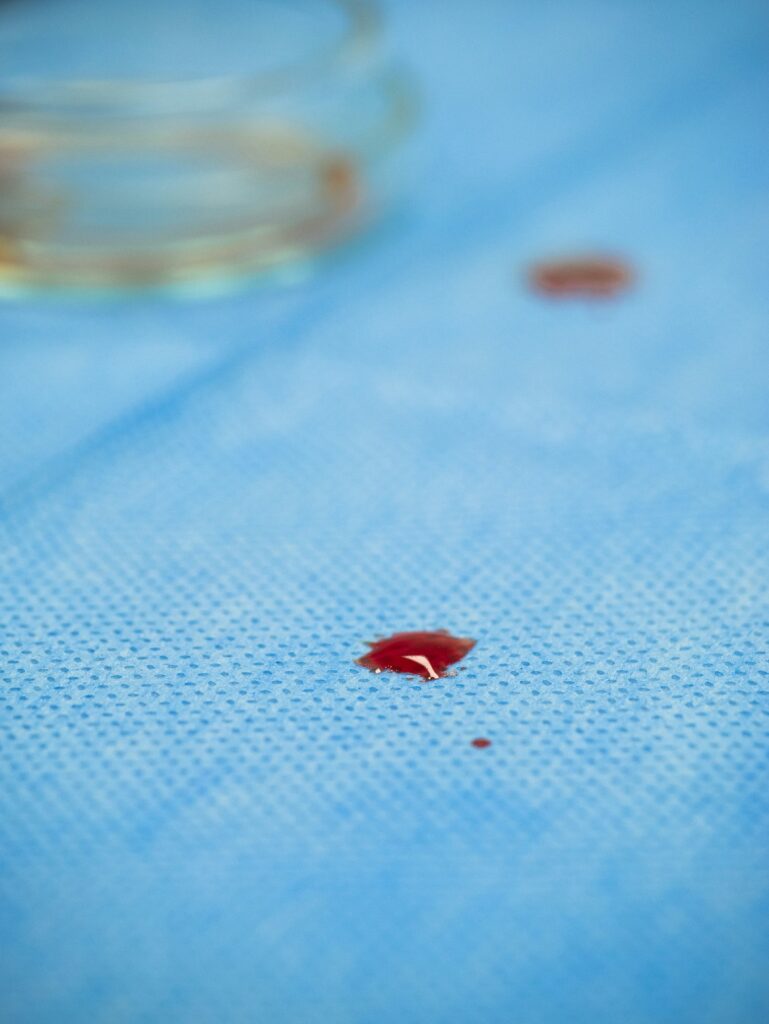 How to Get Period Blood Out of Mattress guide to cold-water blotting, blood stain removal, stain treatments, gentle cleaning, odor control, and mattress care.