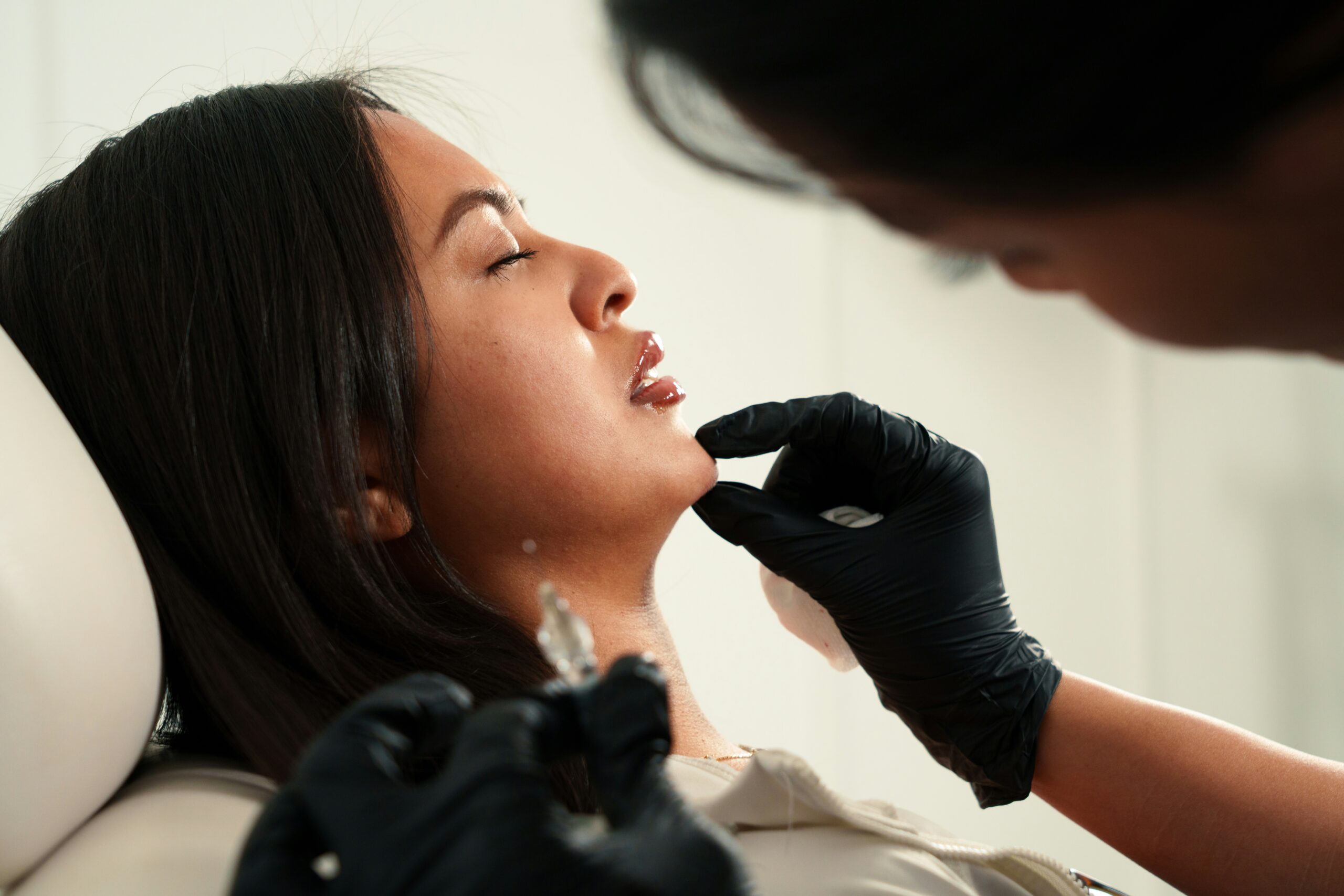 Jawline Buccal Fat Removal 10 Years Later featuring long-term facial changes, jawline definition, aging effects, volume loss, risks, and results.